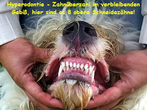 Hyperodontie - Zahnüberzahl im verbleibenden
Gebiß, hier sind es 8 obere Schneidezähne!